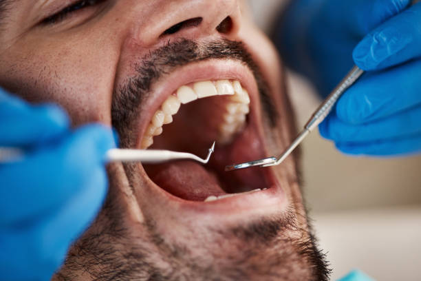 Dental Bonding in Roodhouse, IL