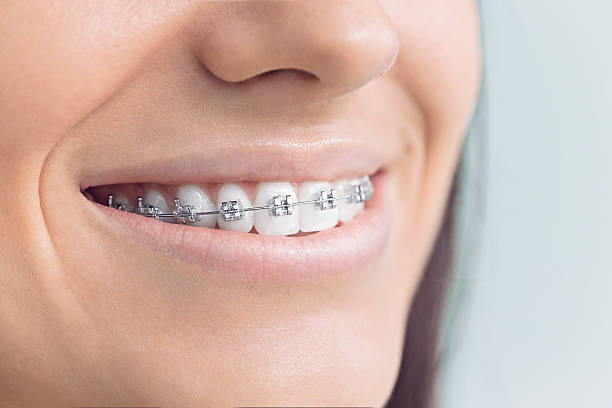 Best Dental Inlays and Onlays  in Roodhouse, IL